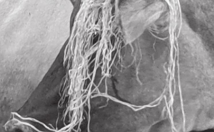 Instead of a photo of herself, a committed “no picture of me” person, Emily Gill provided a photo of Stella, a milk cow who gives her some quiet time away from the daily hubbub at the ranch. Emily says, “She’s photogenic sporting my hate of net wrap.”